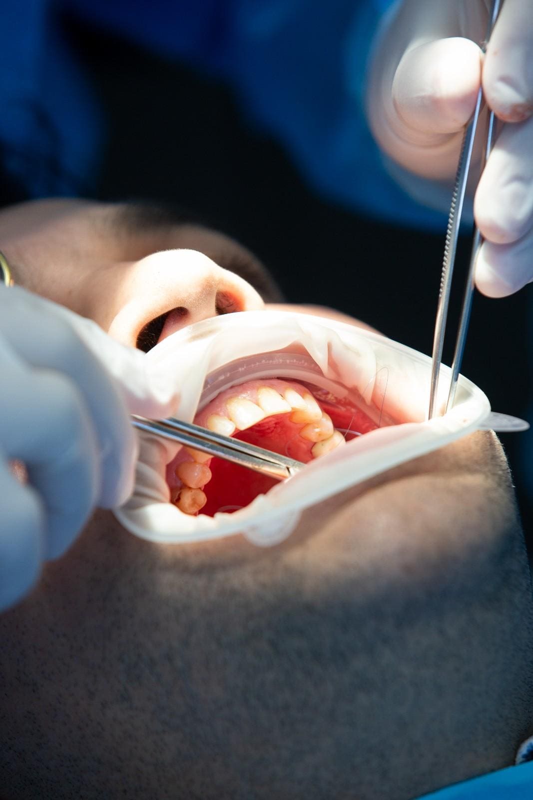 Find Best Dental Clinic in Kothrudr, Pune