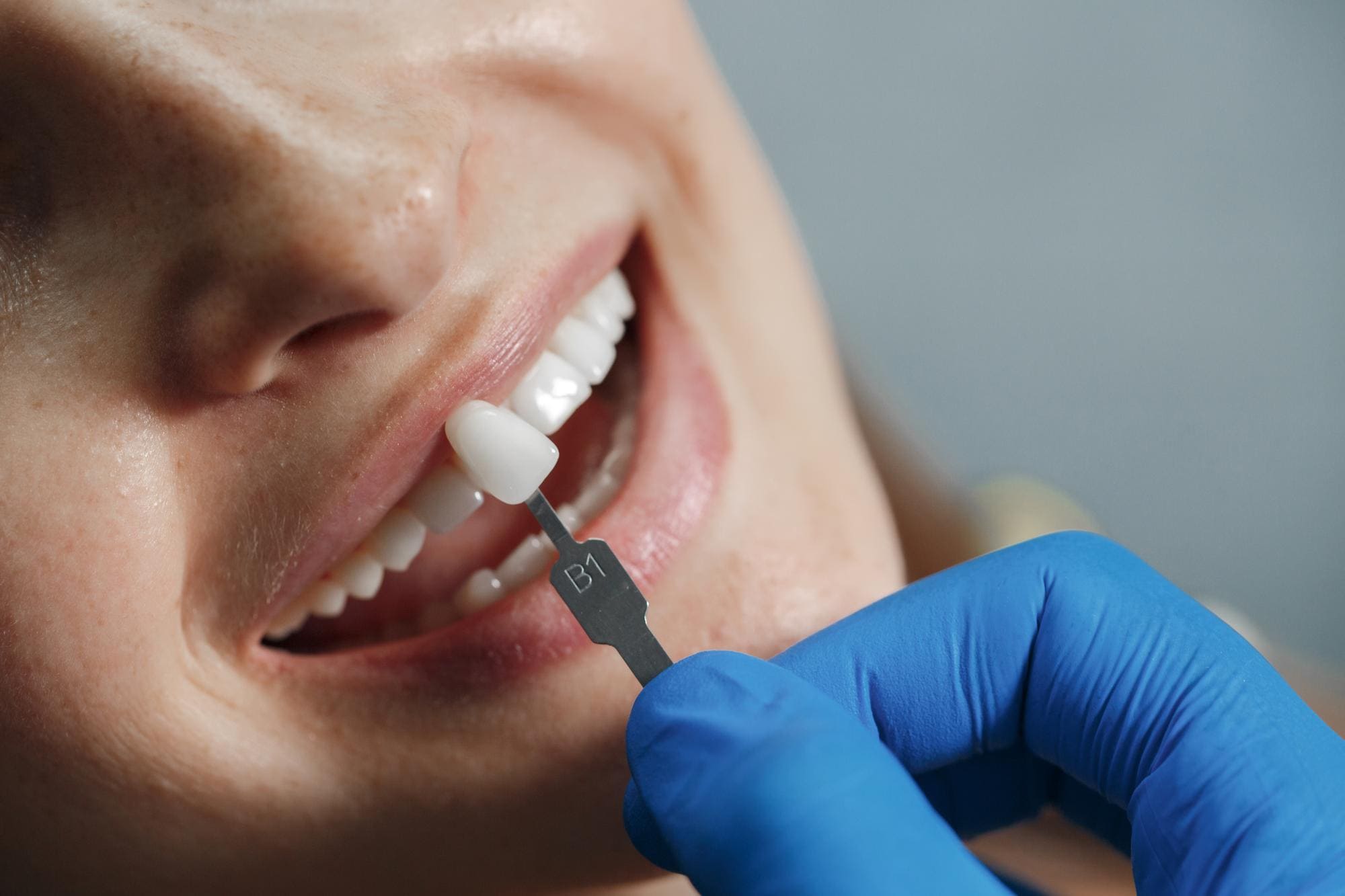 Find Dental Implant In Kothrud, Pune