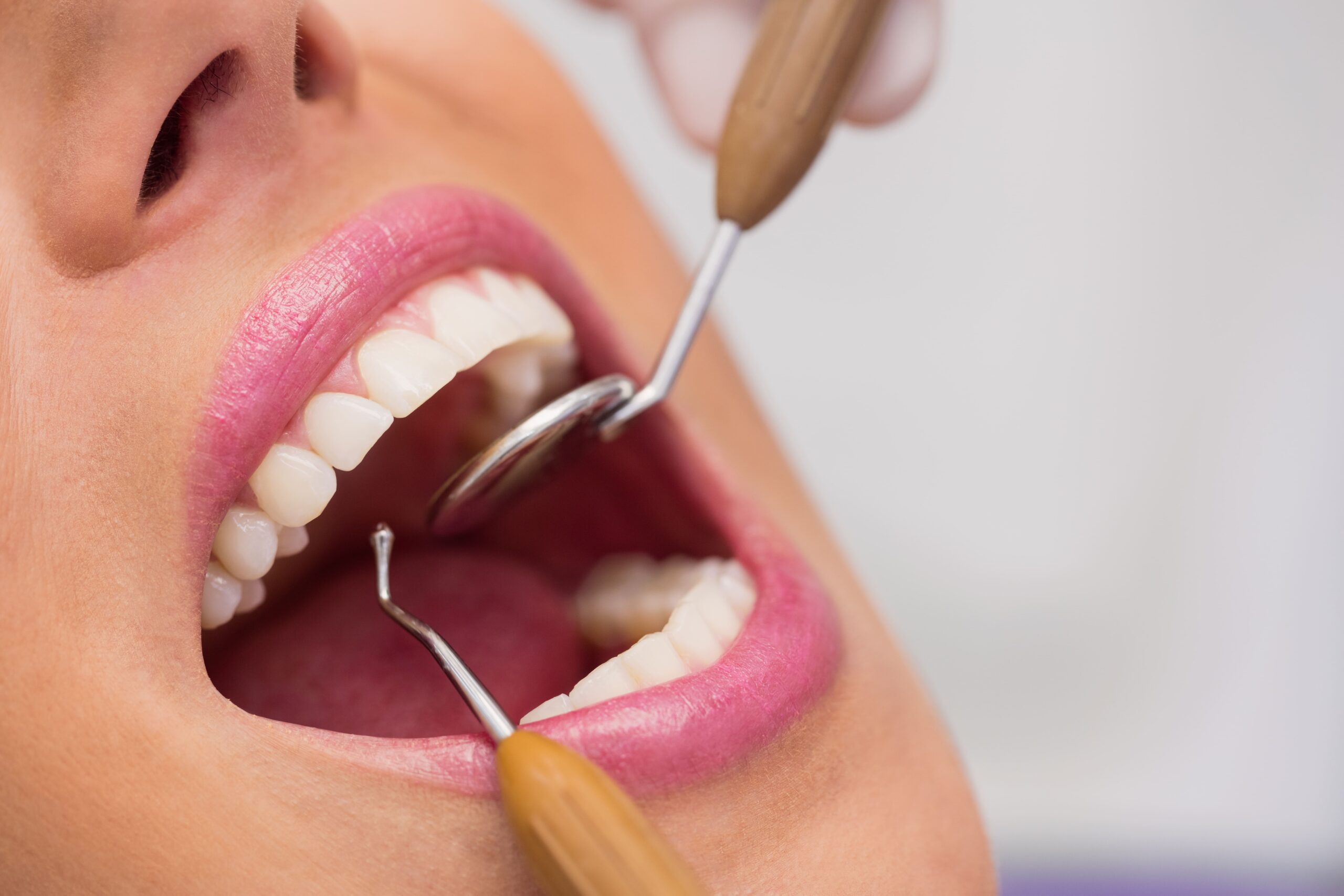 Find Smile designing in kothrud