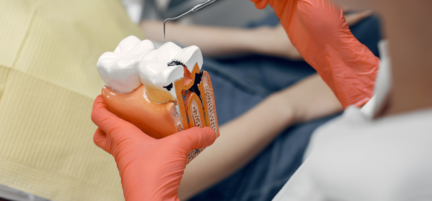 best root canal treatment in kothrud