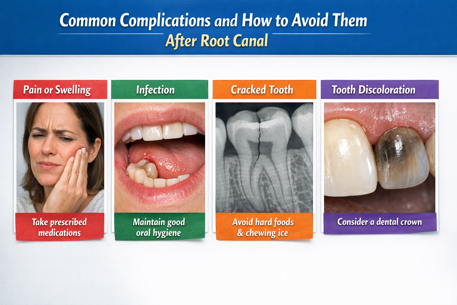 Find out common complications after root canal and how to avoid them with expert guidance from Dr. Saloni Bavalekar.